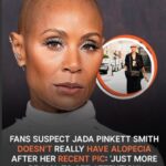 Fans Suspect Jada Pinkett Smith Has No Alopecia after Her Recent Pic: ‘Just More Drama to Get Attention’