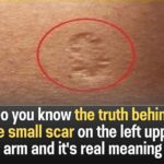 True Meaning Behind the Tiny Scar on Your Upper Left Arm!”