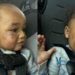 Parents Claim 14-Month-Old Child Suffered Multiple Facial Bites at Day Care – ‘That’s Definitely Neglect’